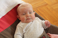 Infant with reddish nose  lying on a crib